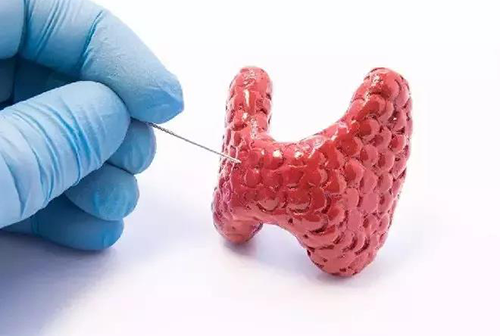 甲状腺疾病，包括甲状腺功能减退和甲状腺功能亢进，自古以来就是反复被医学研究人员研究的疾病